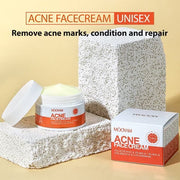 Mooyam Acne Face Cream | كريم موويام لعلاج حب الشباب